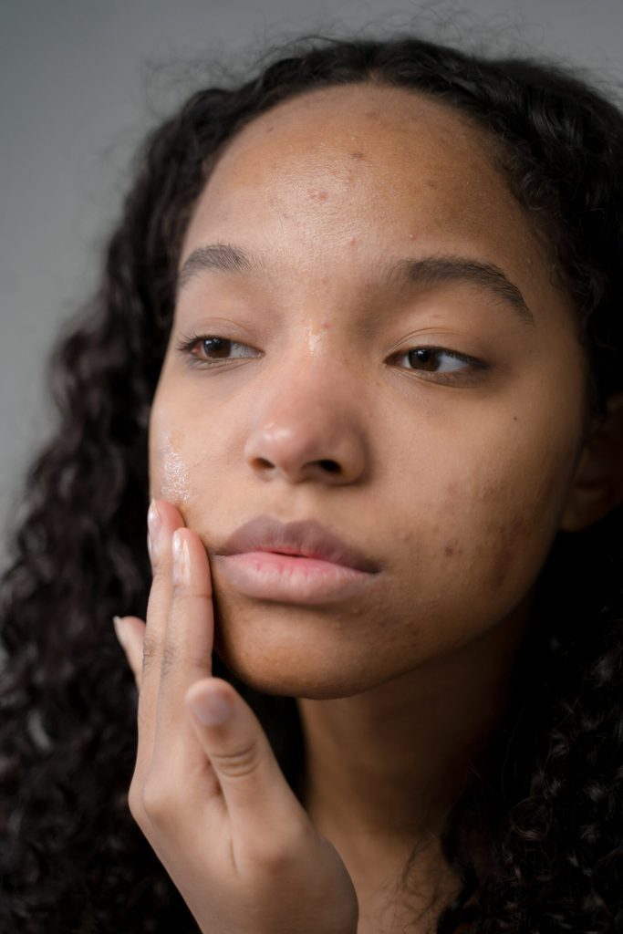Clearer Skin