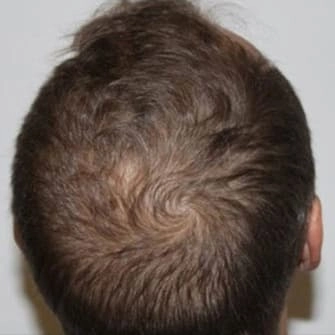 cheveux-3 après