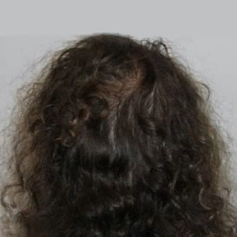 Cheveux Après