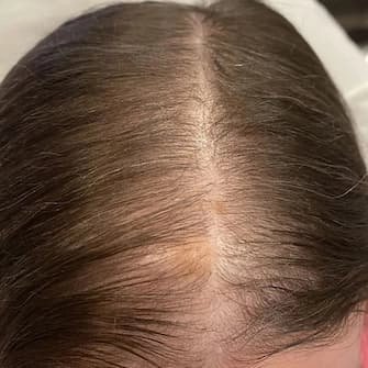 cheveux Après