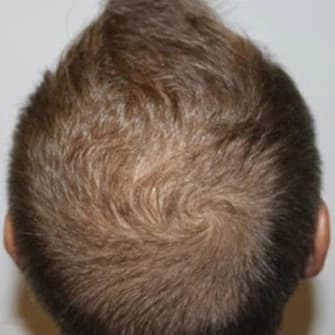 cheveux 3 avant